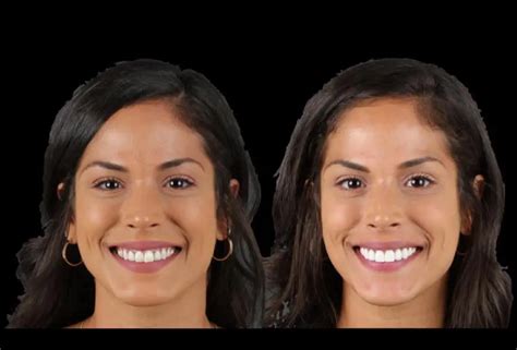 nany gonzalez teeth|Nanys teeth : r/thechallengemtv